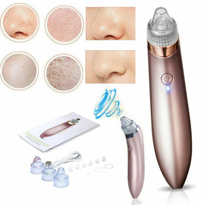 Vacuum Pore Cleaner