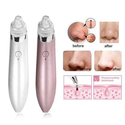 Vacuum Pore Cleaner